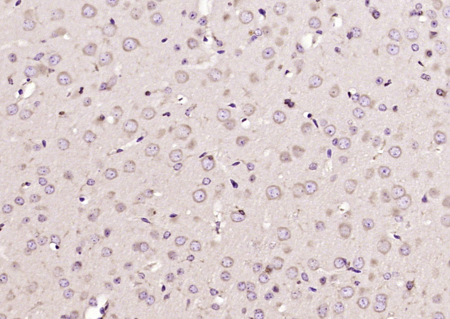 14 - FRMPD2 Rabbit pAb AP59115