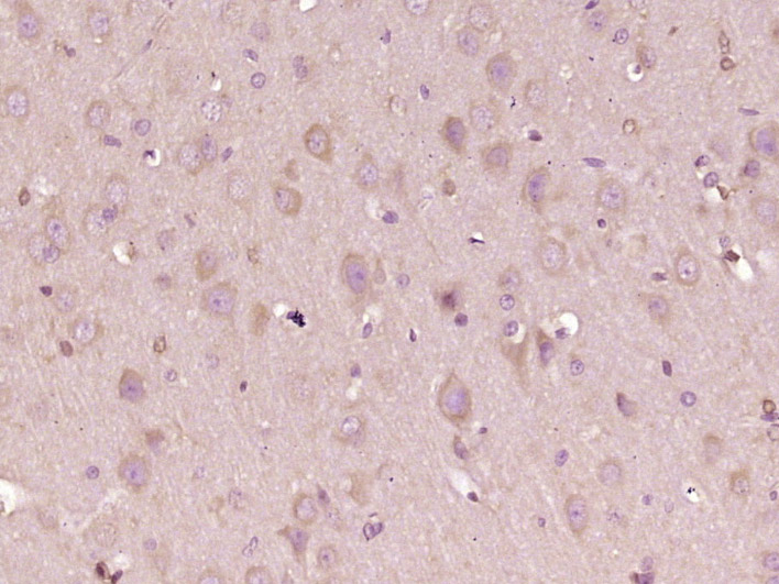 14 - PDZD8 Rabbit pAb AP59118