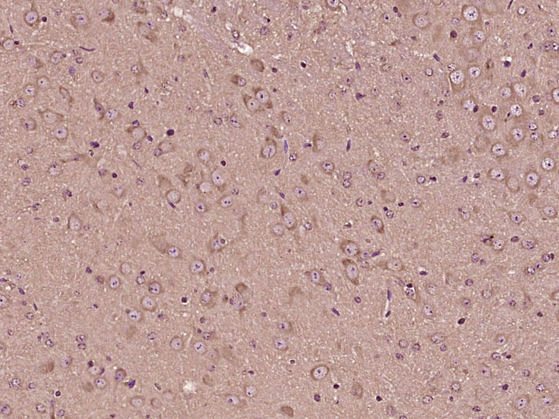 14 - TRPM3 Rabbit pAb AP59119
