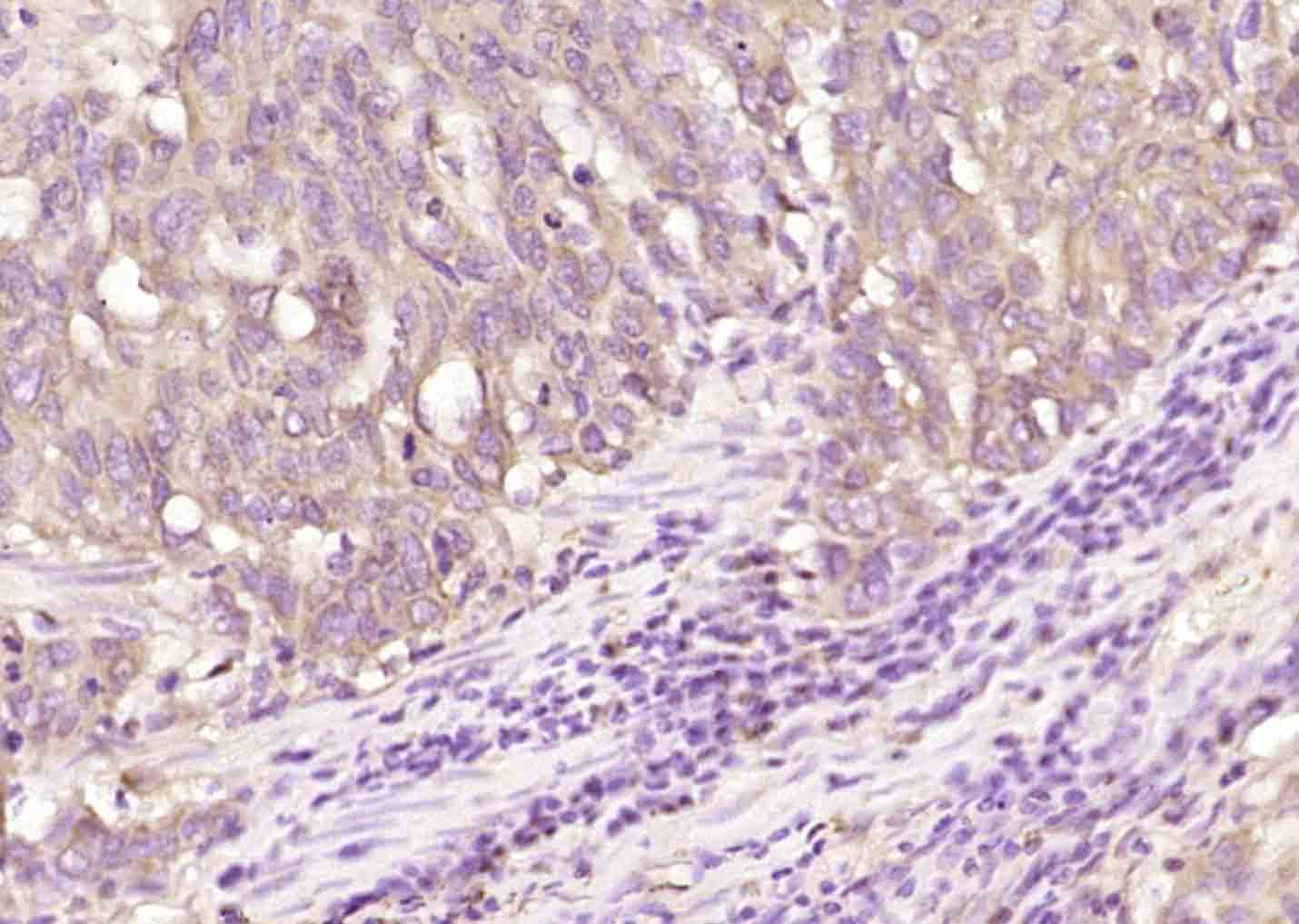14 - TENM3 Rabbit pAb AP59126