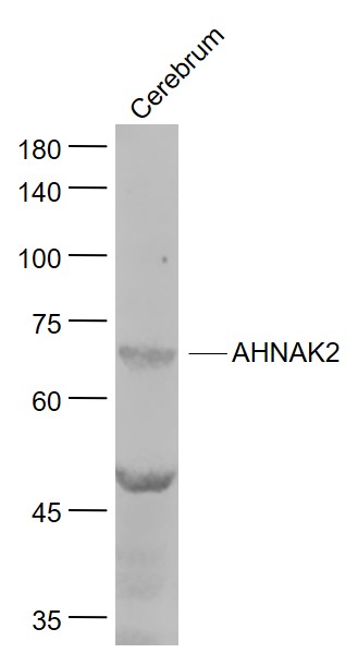 1 - AHNAK2 Rabbit pAb AP59139