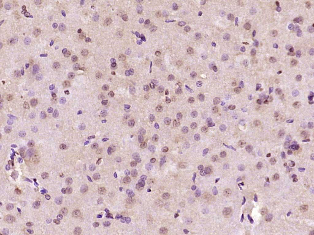 14 - AHNAK2 Rabbit pAb AP59139