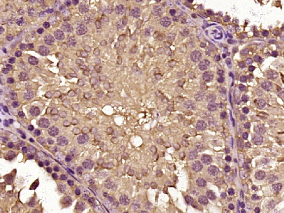14 - ASB7 Rabbit pAb AP59155