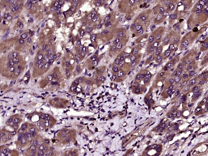 14 - ZNRF3 Rabbit pAb AP59158
