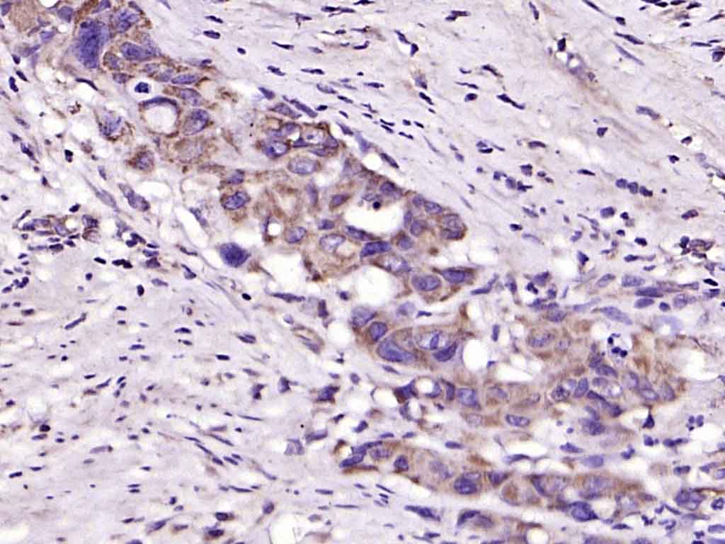 14 - RNF216 Rabbit pAb AP59162