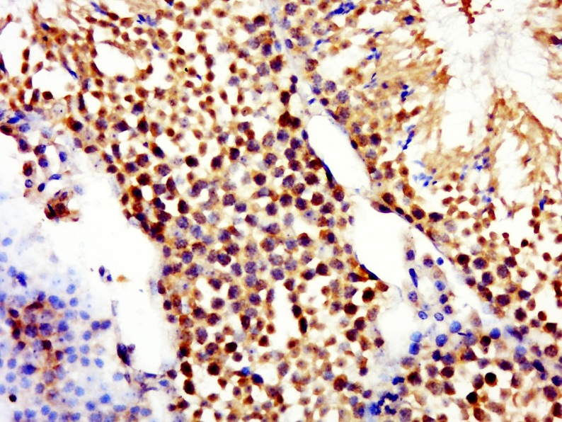 14 - RNF16 Rabbit pAb AP59165