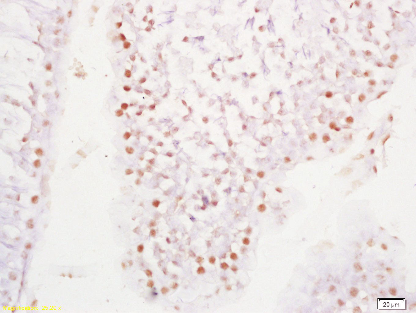 14 - RNF40 Rabbit pAb AP59168