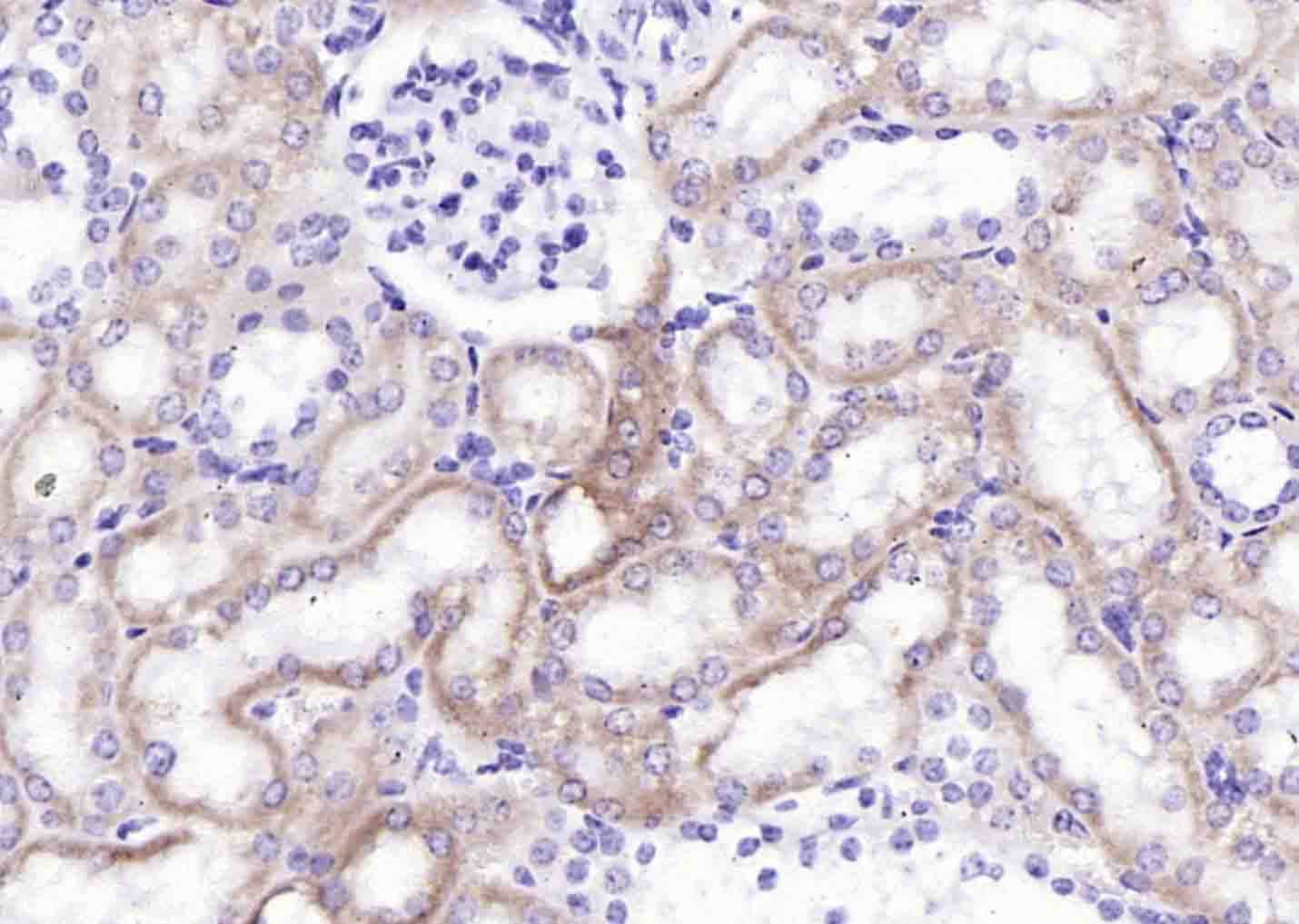 14 - IGSF1 Rabbit pAb AP59178