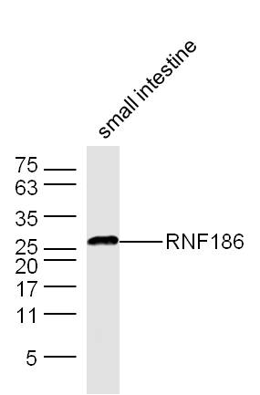 1 - RNF186 Rabbit pAb AP59202