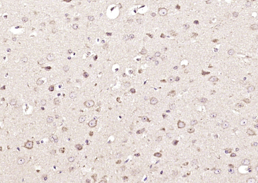 14 - USP9X Rabbit pAb AP59205