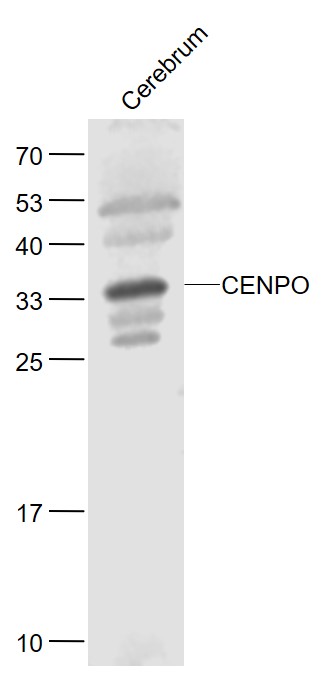 1 - CENPO Rabbit pAb AP59212