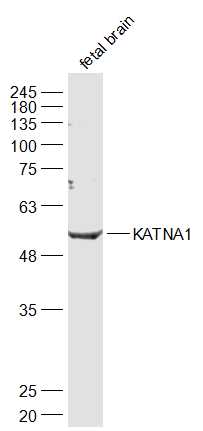 1 - KATNA1 Rabbit pAb AP59215