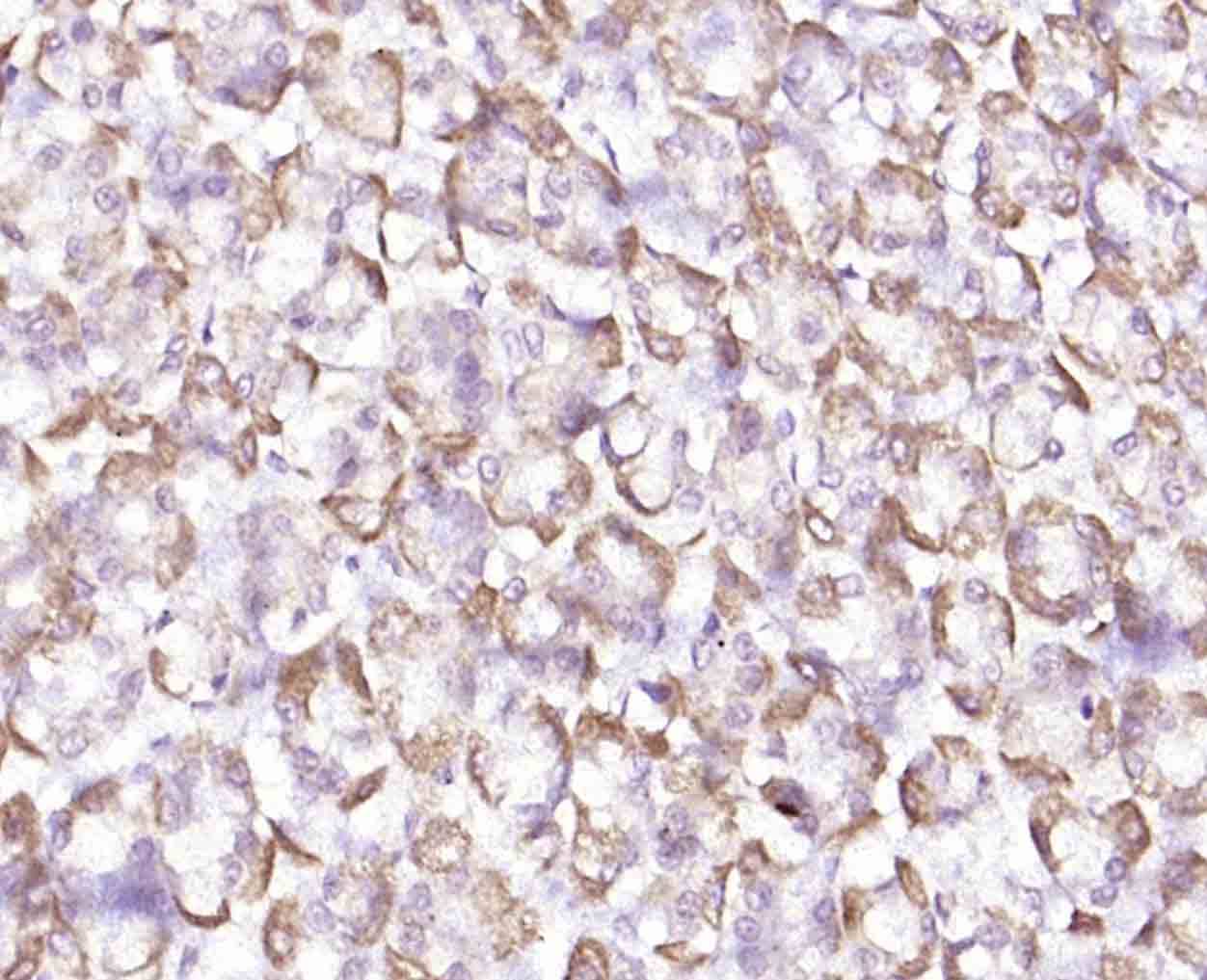 14 - KATNA1 Rabbit pAb AP59215