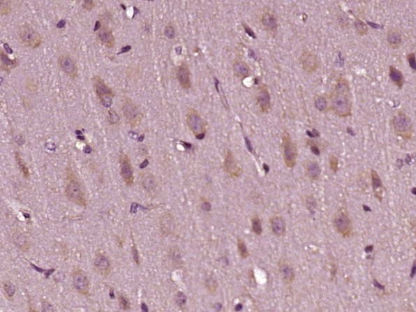 14 - LRCH3 Rabbit pAb AP59224