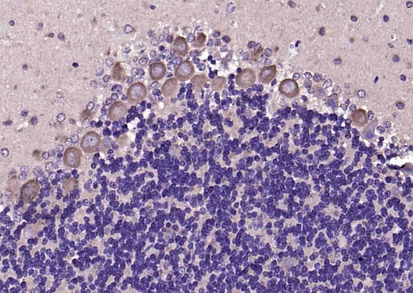 14 - MARCH8 Rabbit pAb AP59231