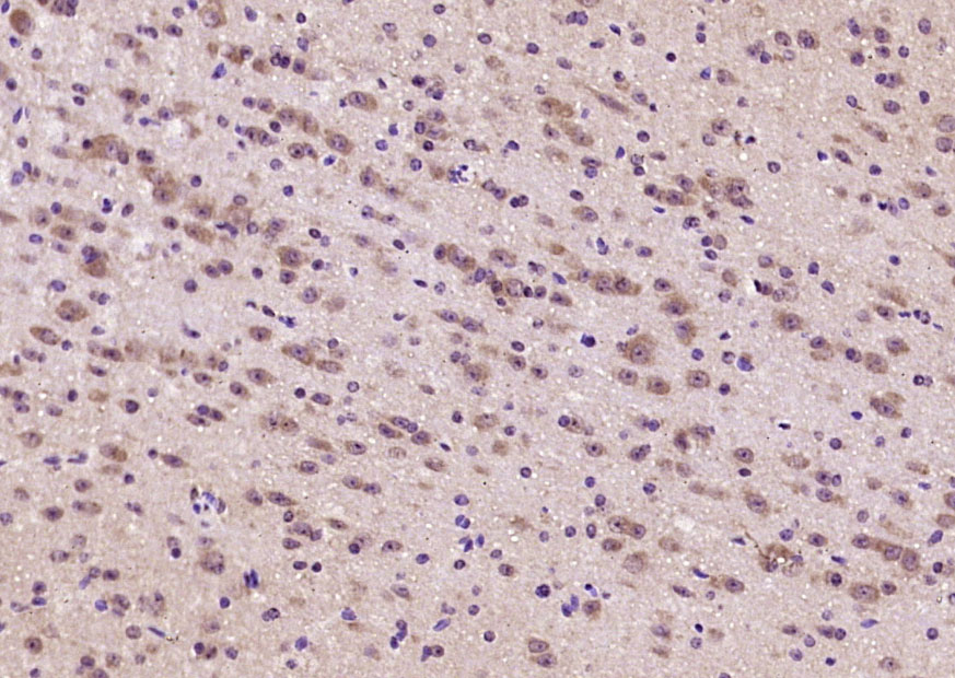 14 - ANKRD33B Rabbit pAb AP59244