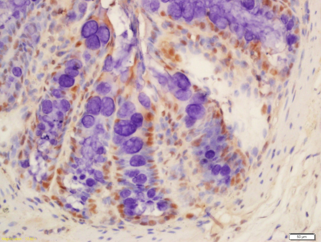 14 - KCTD5 Rabbit pAb AP59254