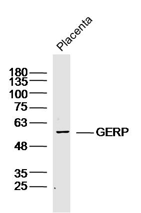1 - GERP Rabbit pAb AP59255