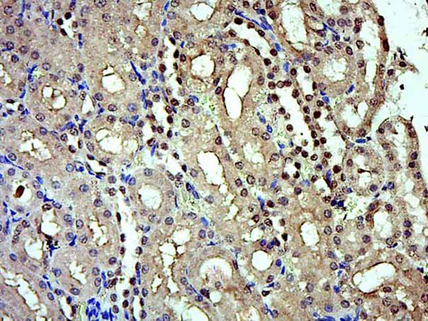 14 - IRX5 Rabbit pAb AP59262
