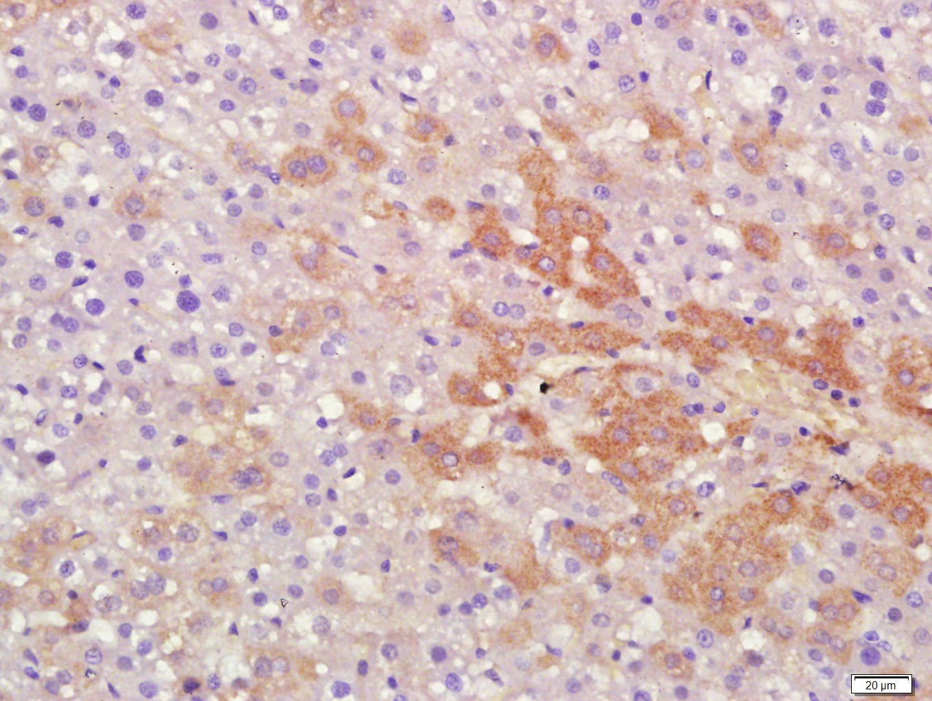 14 - Protein S Rabbit pAb AP59278