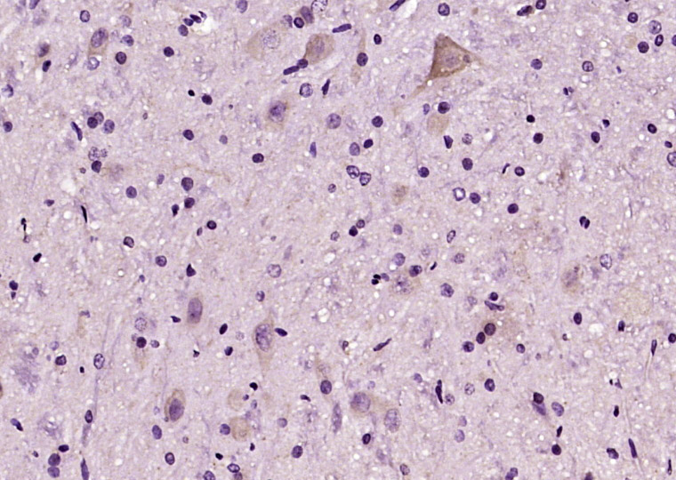 14 - C6orf120 Rabbit pAb AP59283