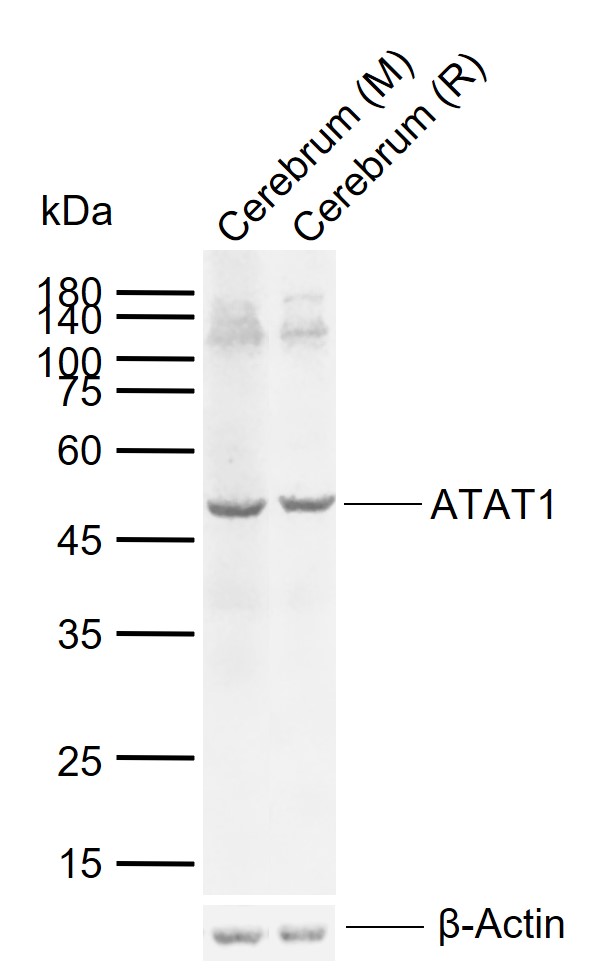 1 - ATAT1 Rabbit pAb AP59284