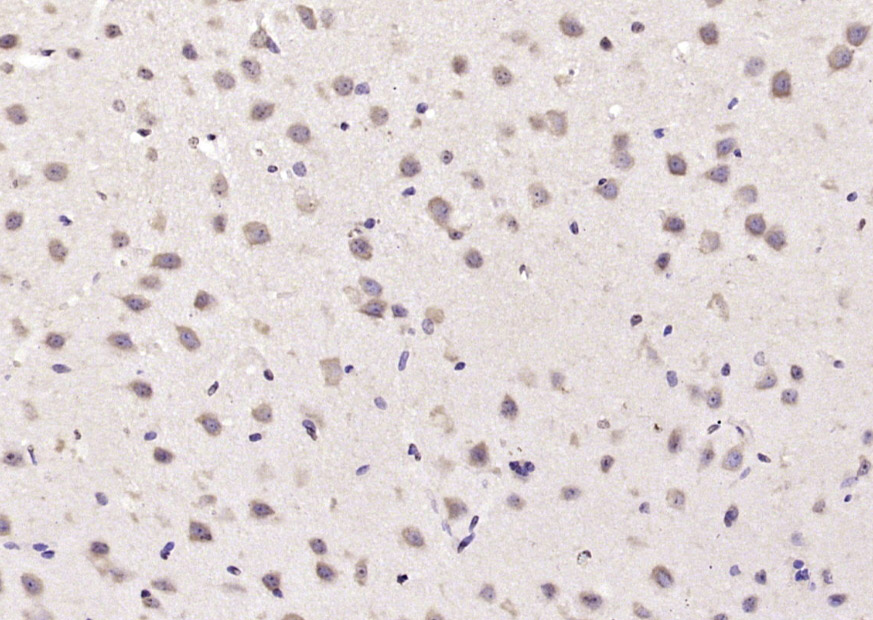 14 - ATAT1 Rabbit pAb AP59284