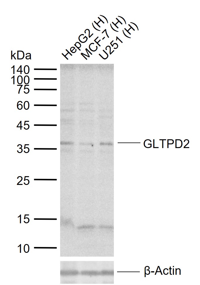 1 - GLTPD2 Rabbit pAb AP59290