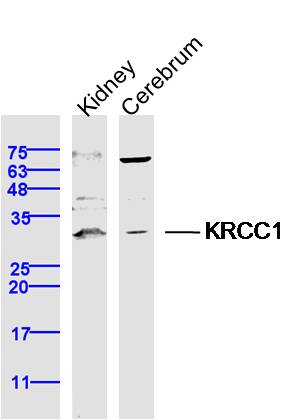 1 - KRCC1 Rabbit pAb AP59291
