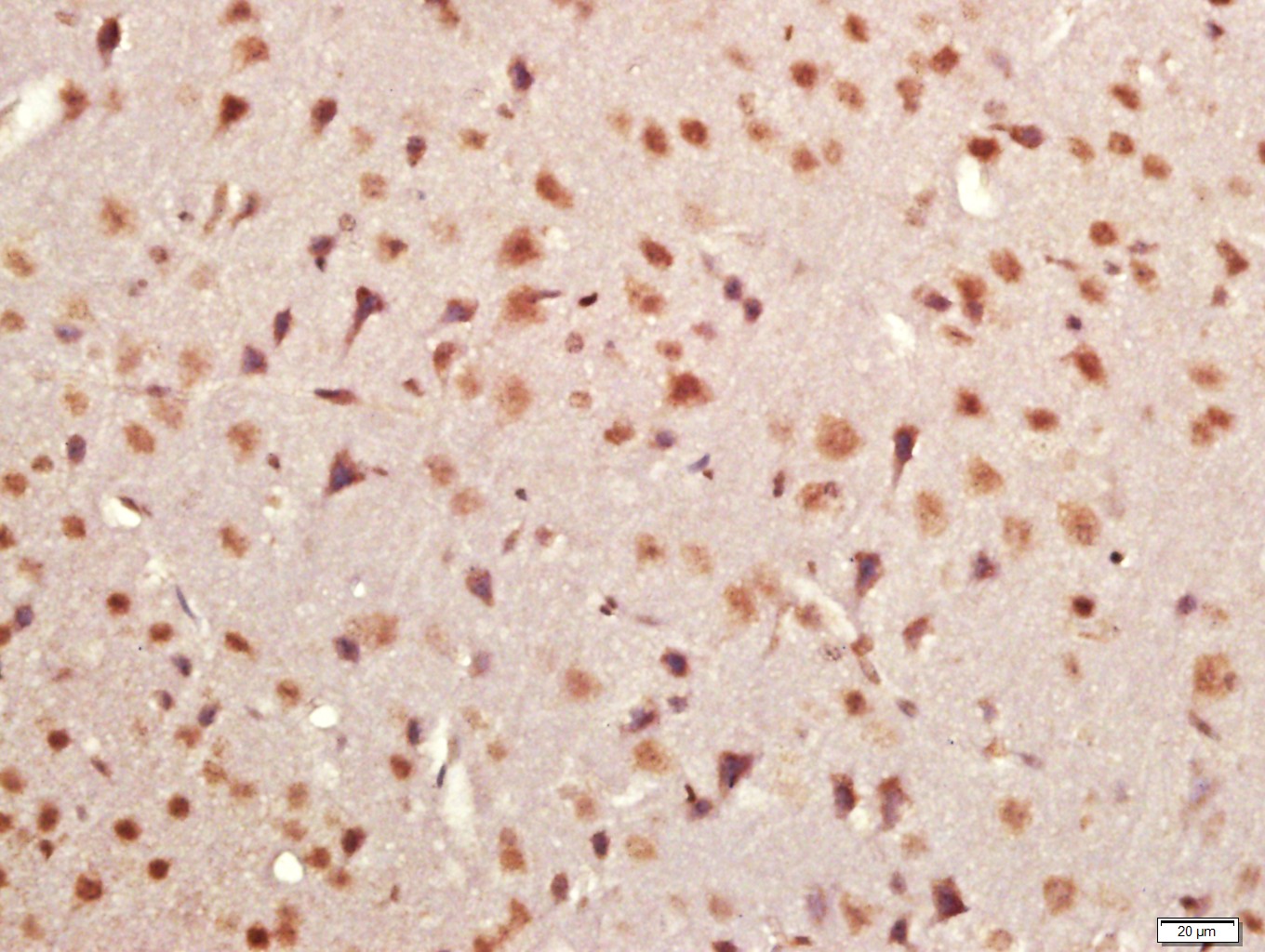 14 - KRCC1 Rabbit pAb AP59291