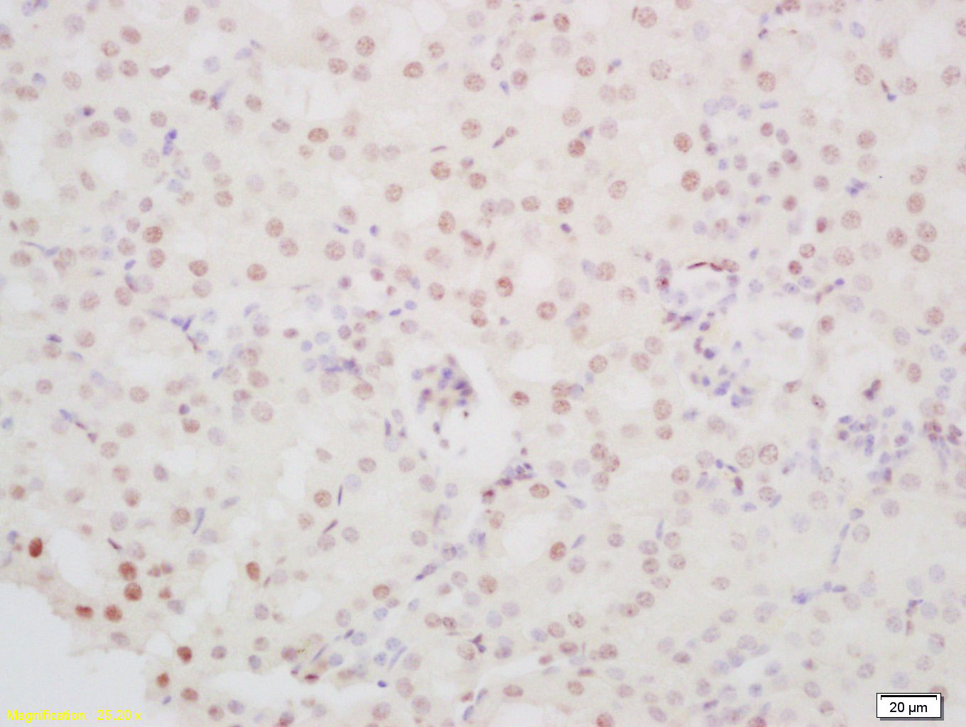 14 - PINX-1 Rabbit pAb AP59299