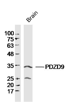 1 - PDZD9 Rabbit pAb AP59317