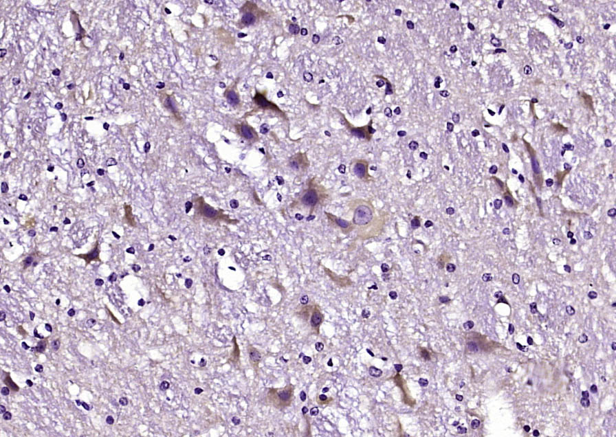 14 - PDZD9 Rabbit pAb AP59317