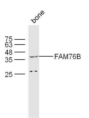 1 - FAM76B Rabbit pAb AP59333