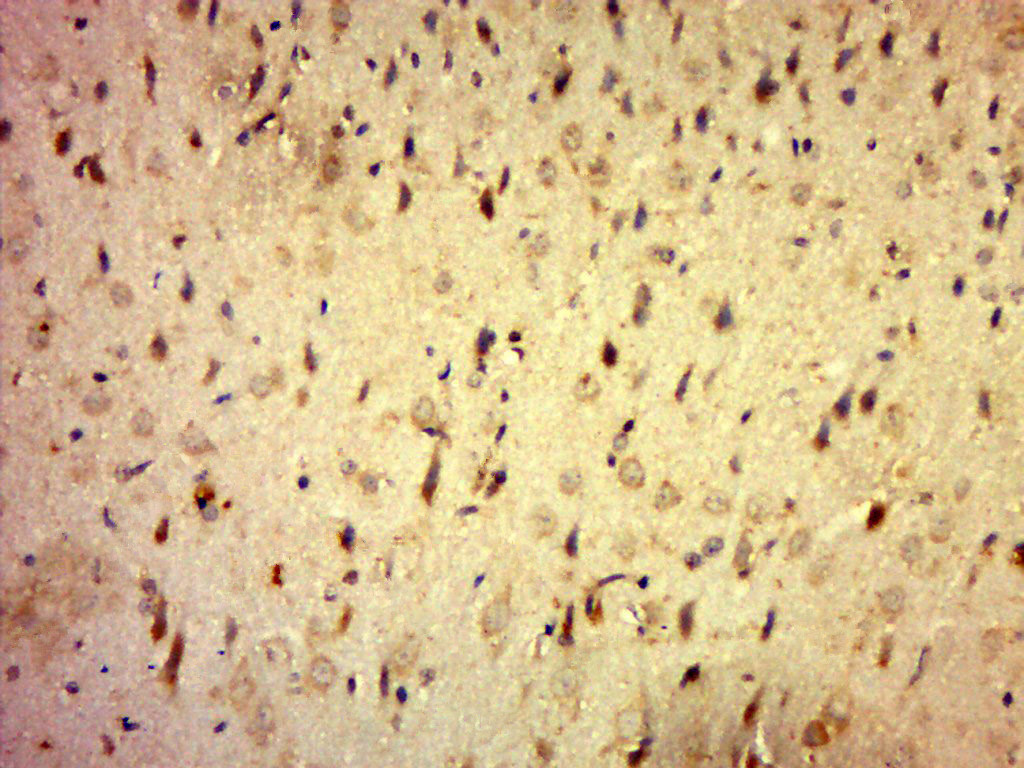 14 - C20orf196 Rabbit pAb AP59351