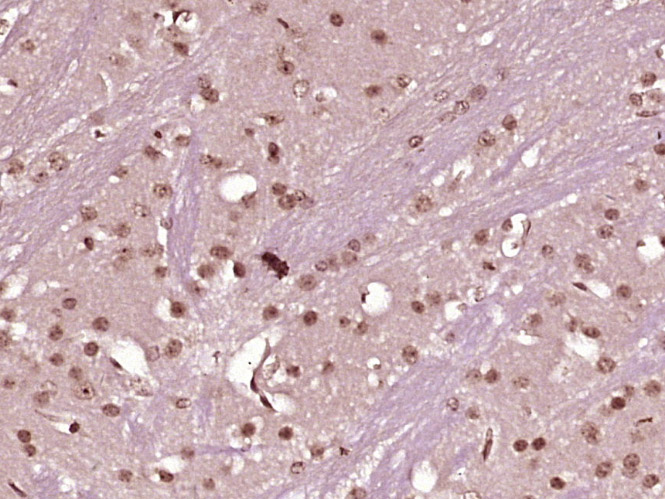 14 - C20orf43 Rabbit pAb AP59352