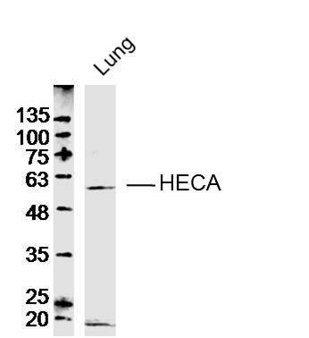 1 - HECA Rabbit pAb AP59353