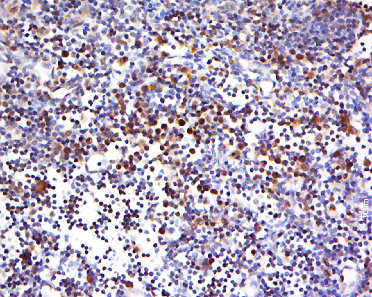 14 - HECA Rabbit pAb AP59353