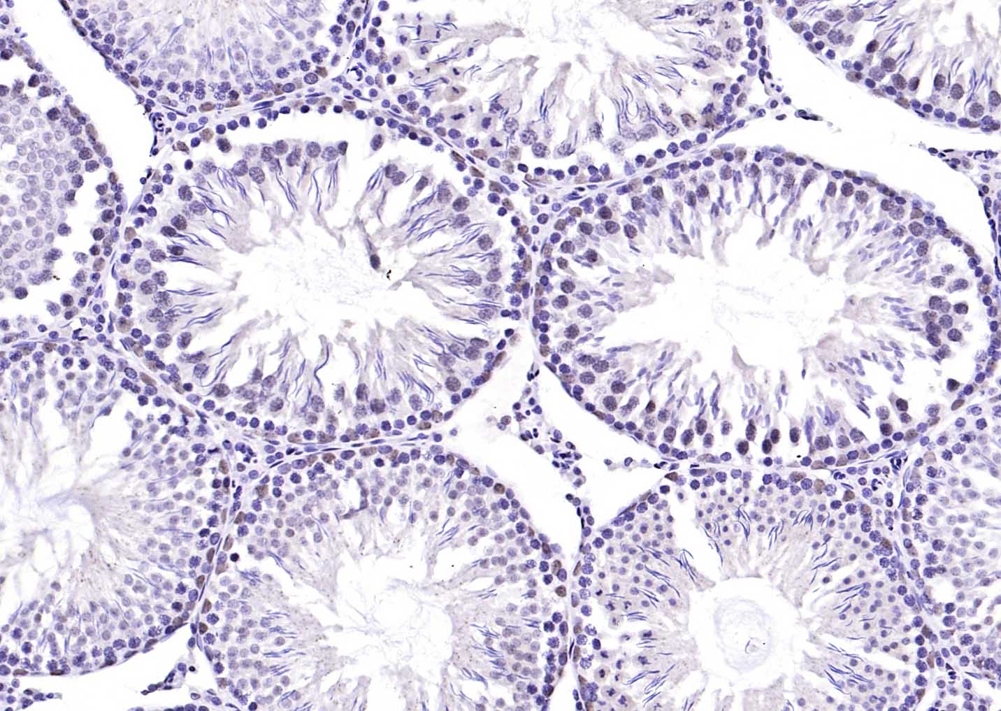 14 - TSSK6 Rabbit pAb AP59367