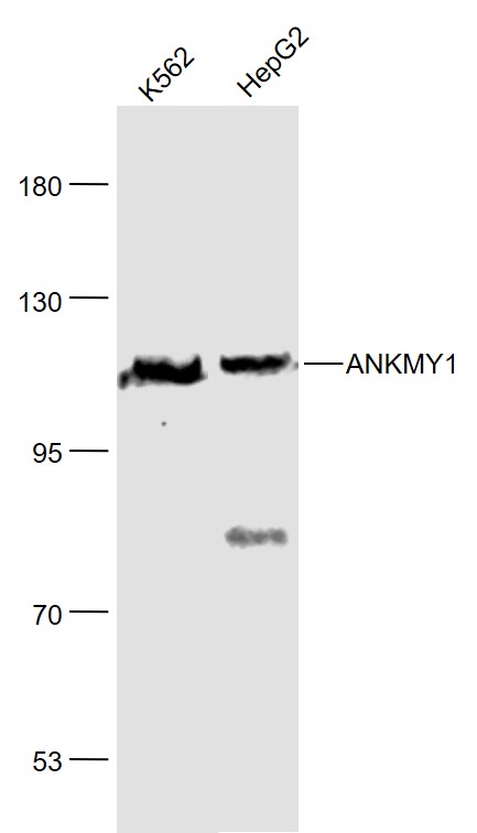 1 - ANKMY1 Rabbit pAb AP59372