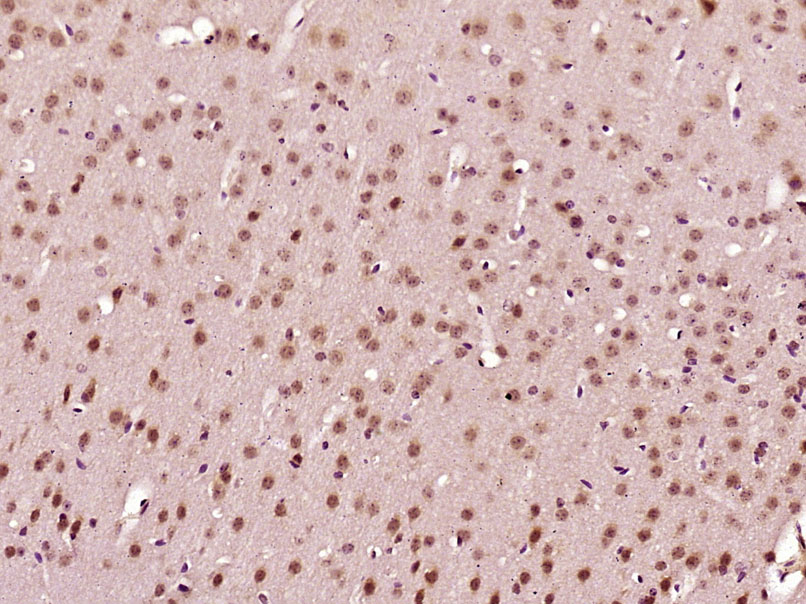 14 - C1orf125 Rabbit pAb AP59381