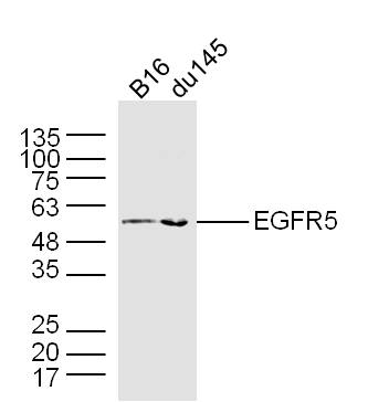 1 - EGFR5 Rabbit pAb AP59390