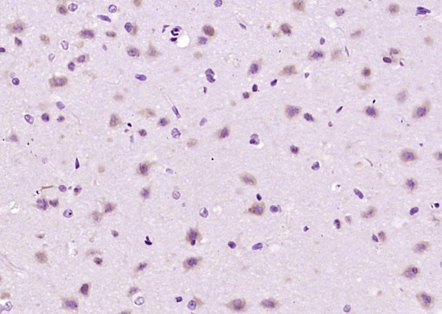 14 - C2orf43 Rabbit pAb AP59393