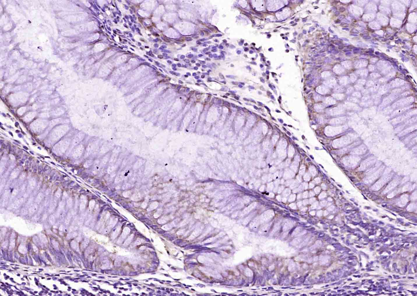 14 - HCN3 Rabbit pAb AP59406