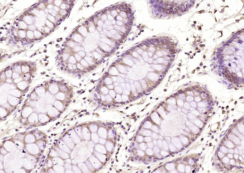 14 - Adropin Rabbit pAb AP59415