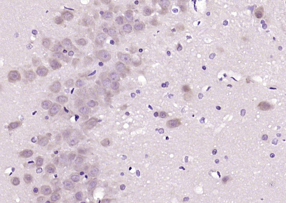 14 - PAFAHG Rabbit pAb AP59417