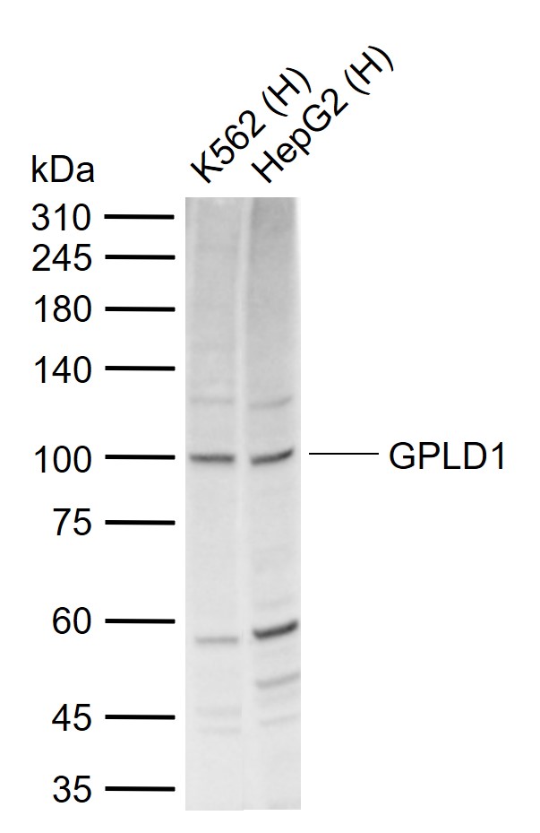 1 - GPLD1 Rabbit pAb AP59419