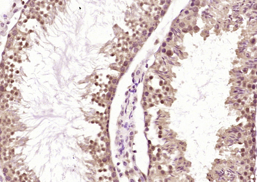 14 - WDFY3 Rabbit pAb AP59425