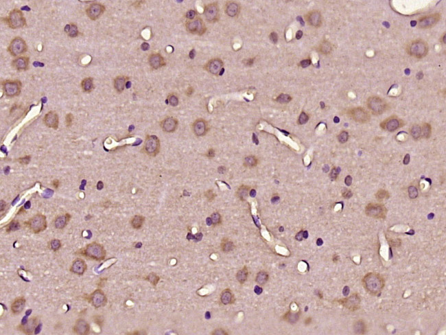 14 - C11orf57 Rabbit pAb AP59431