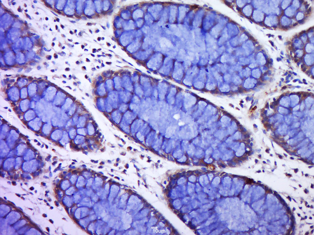 14 - C12ORF42 Rabbit pAb AP59436
